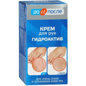 До и после крем д/рук гидроактив 100мл. /твинс тэк/